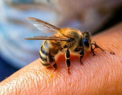 Jak zvládnout včelí bodnutí? rady a doporučení pro včelaře